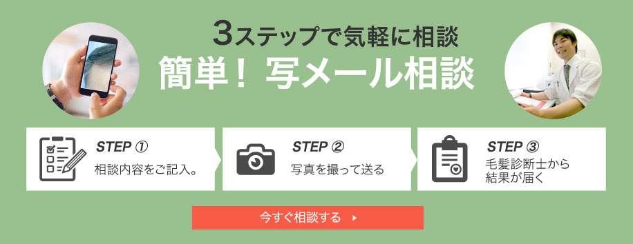 3ステップで気軽に相談 簡単!写メール診断